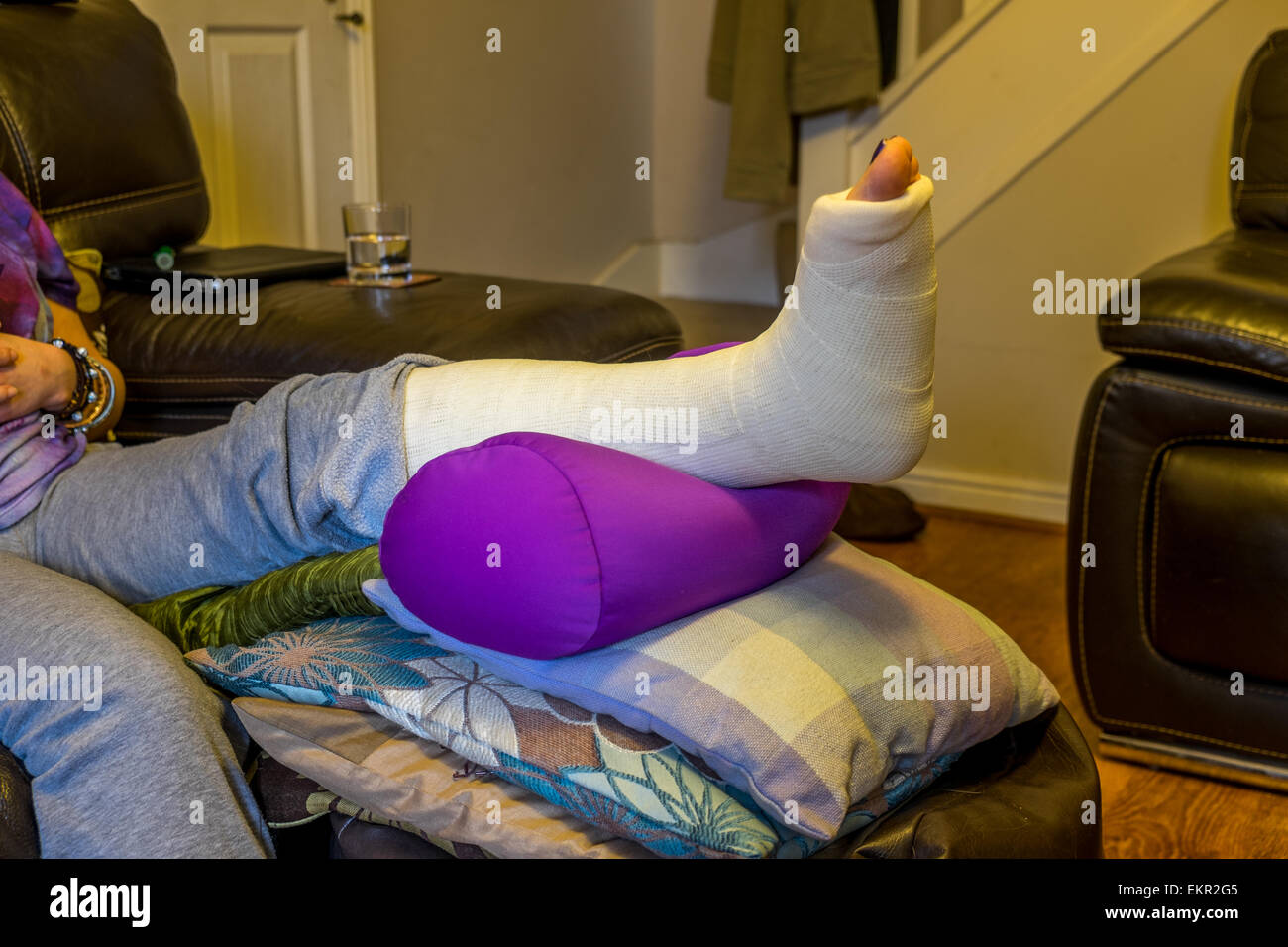 Lady with a broken ankle with her leg in an elevated position Stock Photo