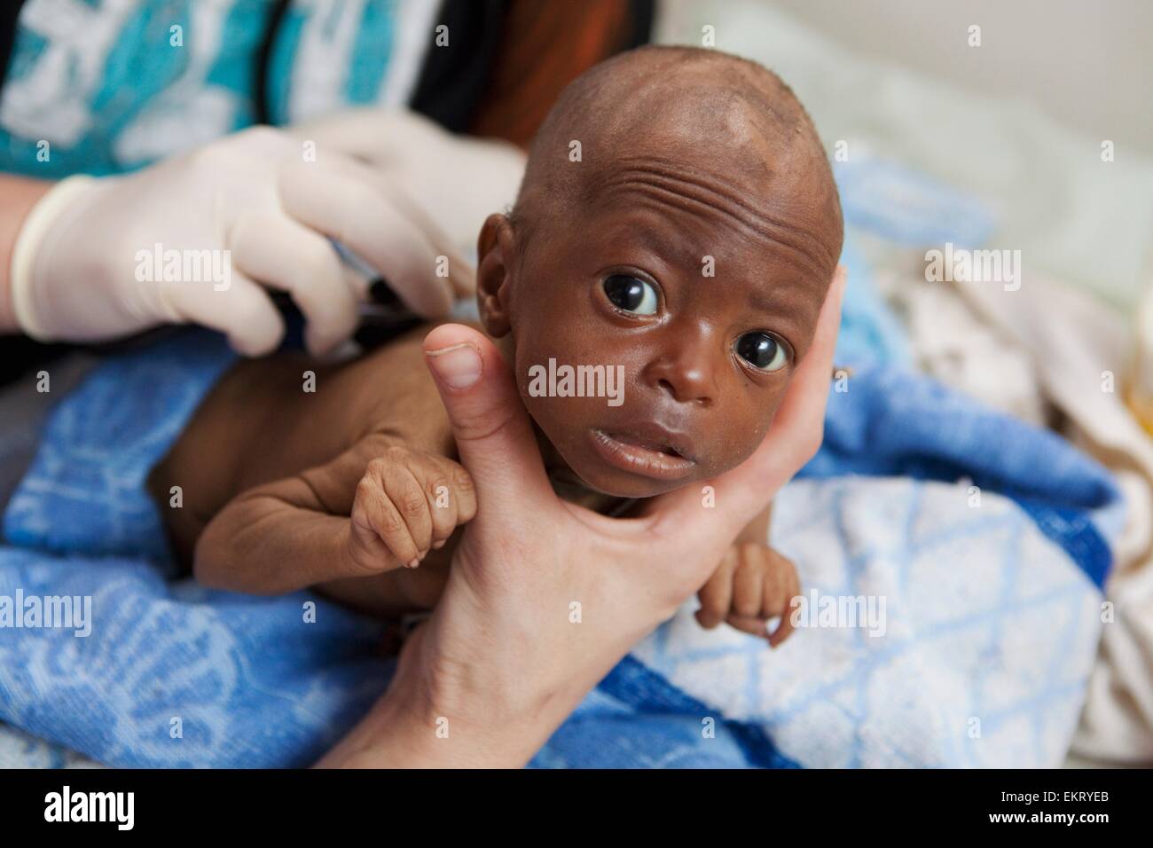 hiv-patient-child