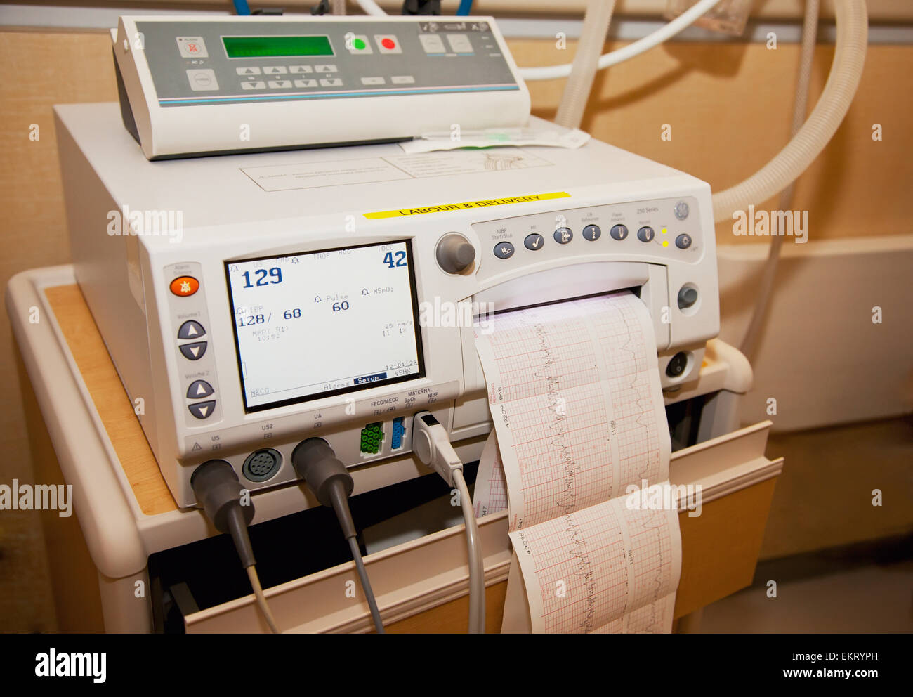 baby heart monitor machine