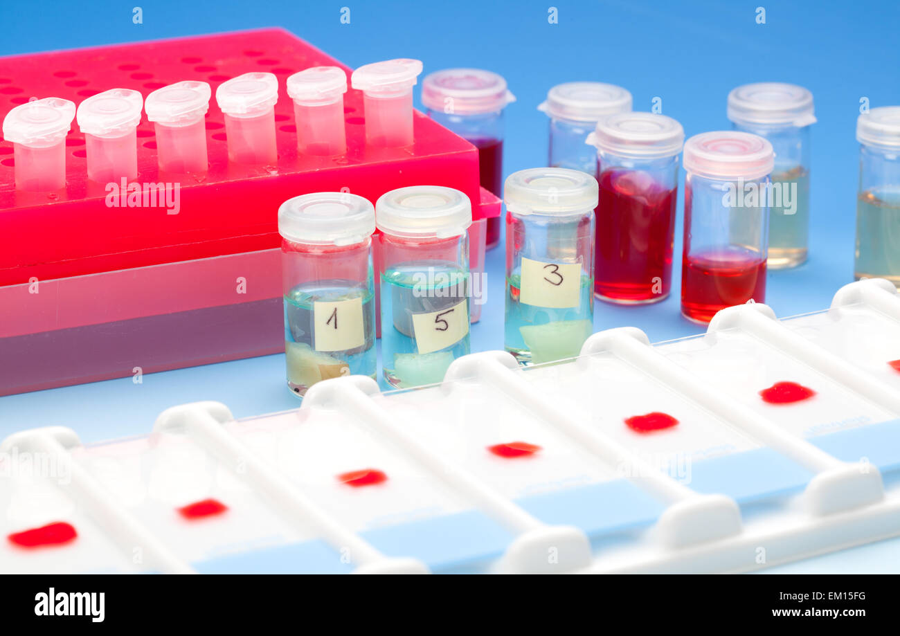 Array of blood samples for microscopy and biopsy tissue on blue Stock Photo