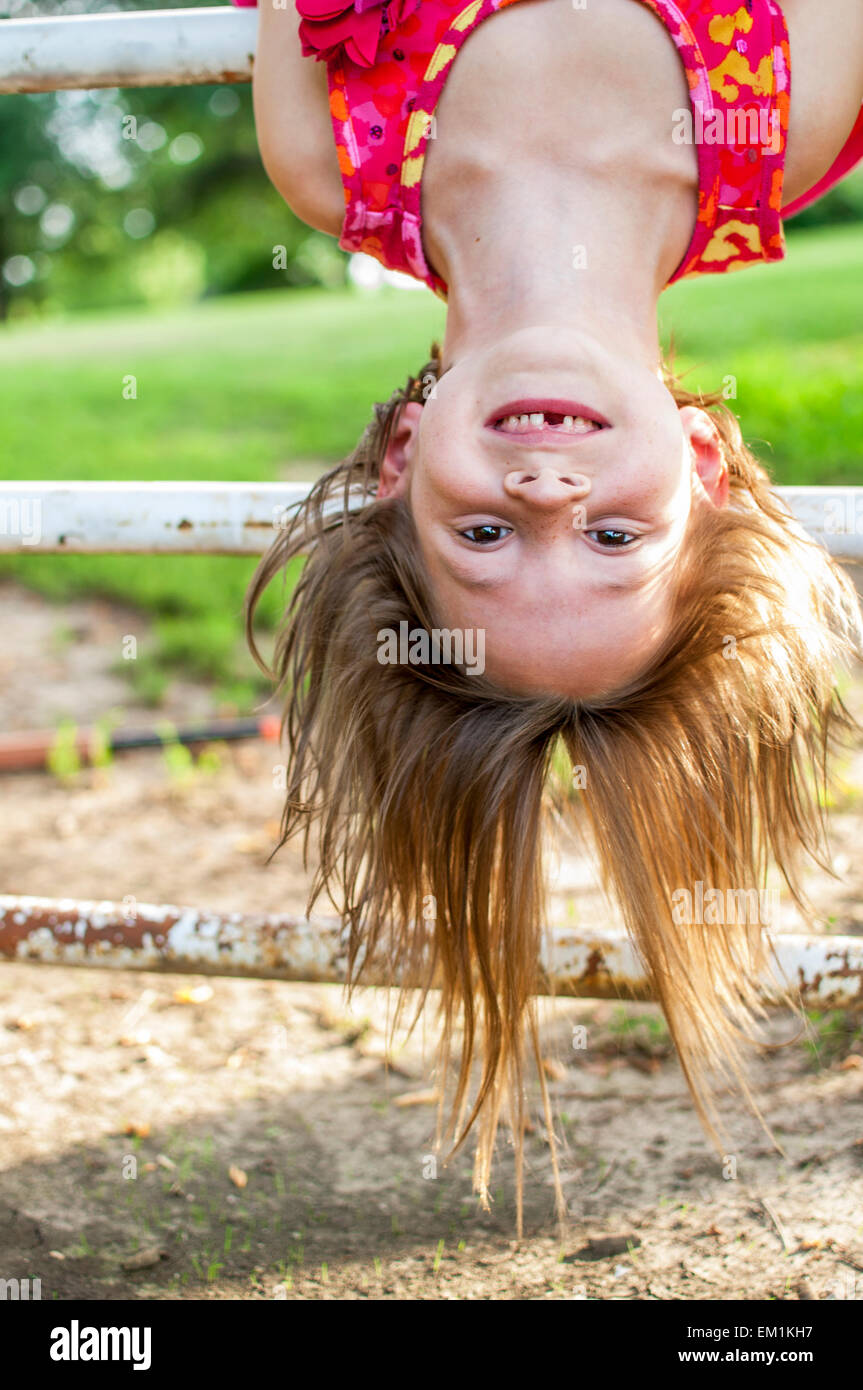 Girl Missing Teeth Upside Down Stock Photo 81171923 Alamy