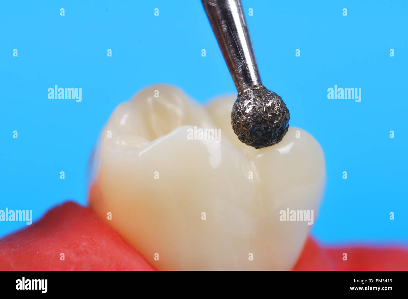 dental drill and tooth extra close up Stock Photo Alamy