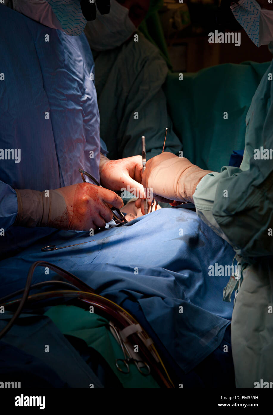 surgery operation Stock Photo