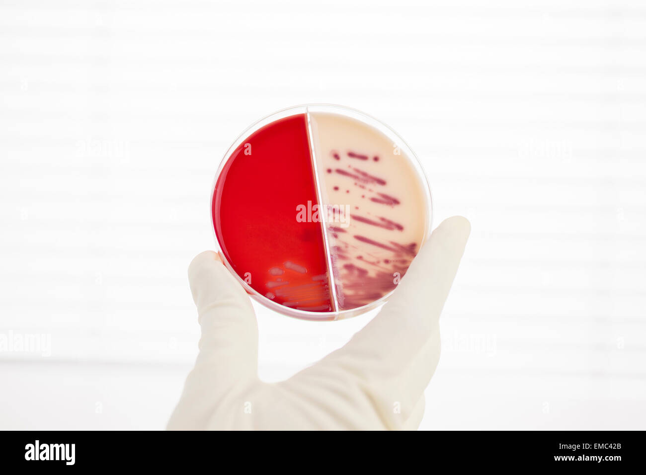 Laboratory technician examining agar plate with bacteria Stock Photo