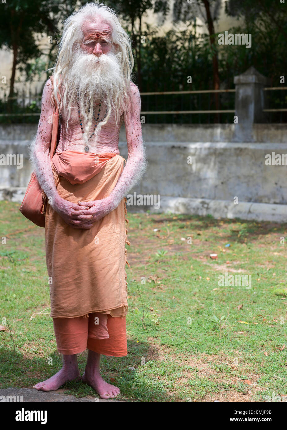 Albino man hi-res stock photography and images - Alamy