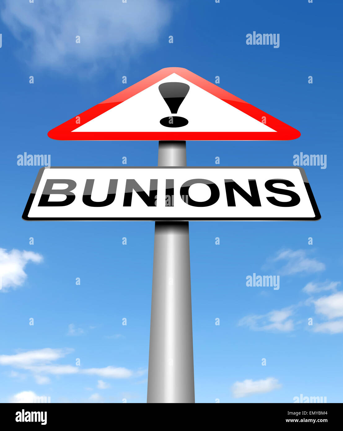 Bunions concept. Stock Photo