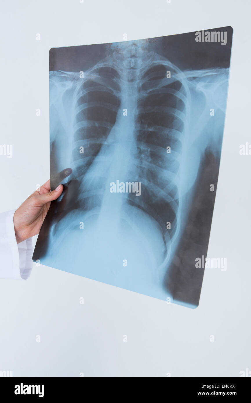 Doctor holding at XRays Stock Photo Alamy