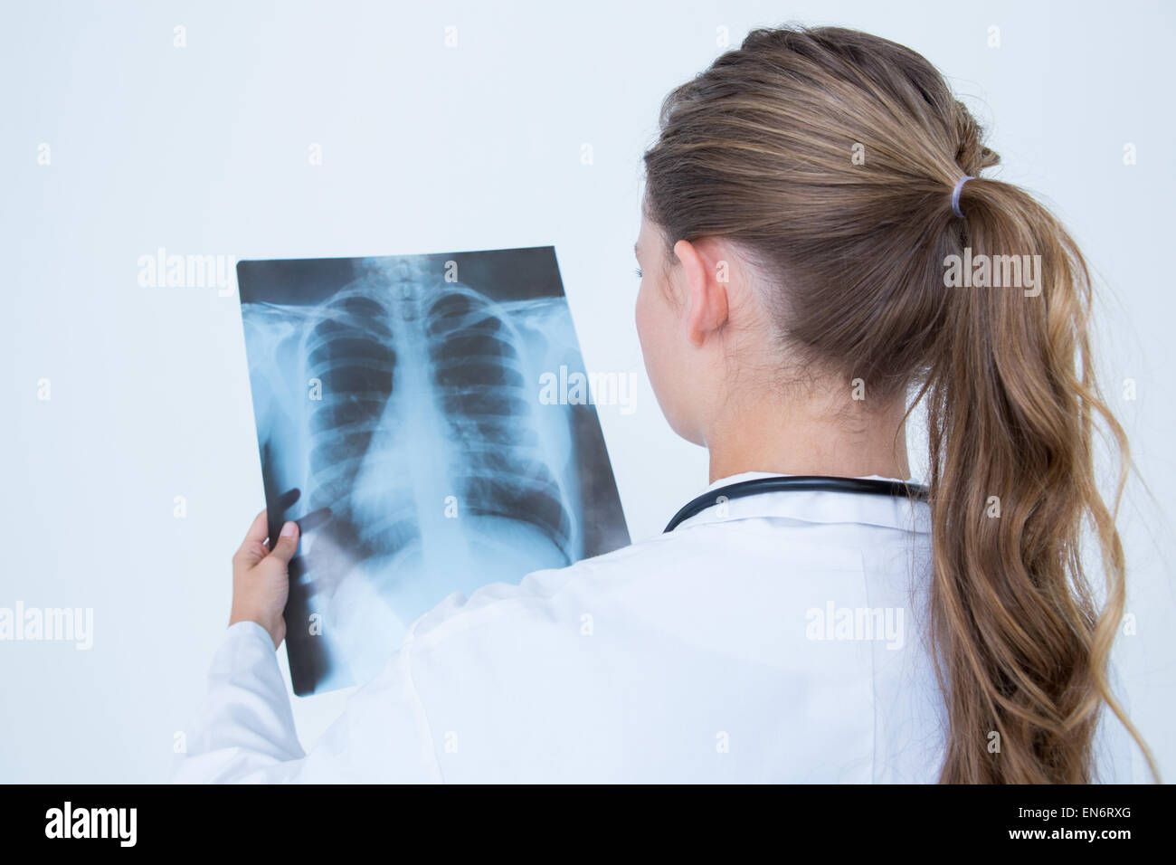 Woman looking at x ray hi-res stock photography and images - Alamy