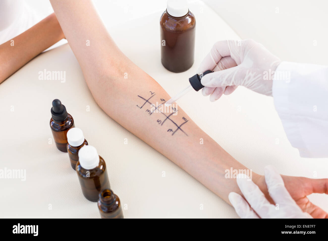 Doctor doing skin prick test at her patient Stock Photo