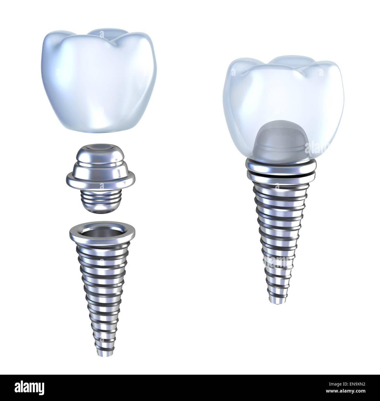 Dental implant 3d crown with pin isolated on white Stock Photo Alamy