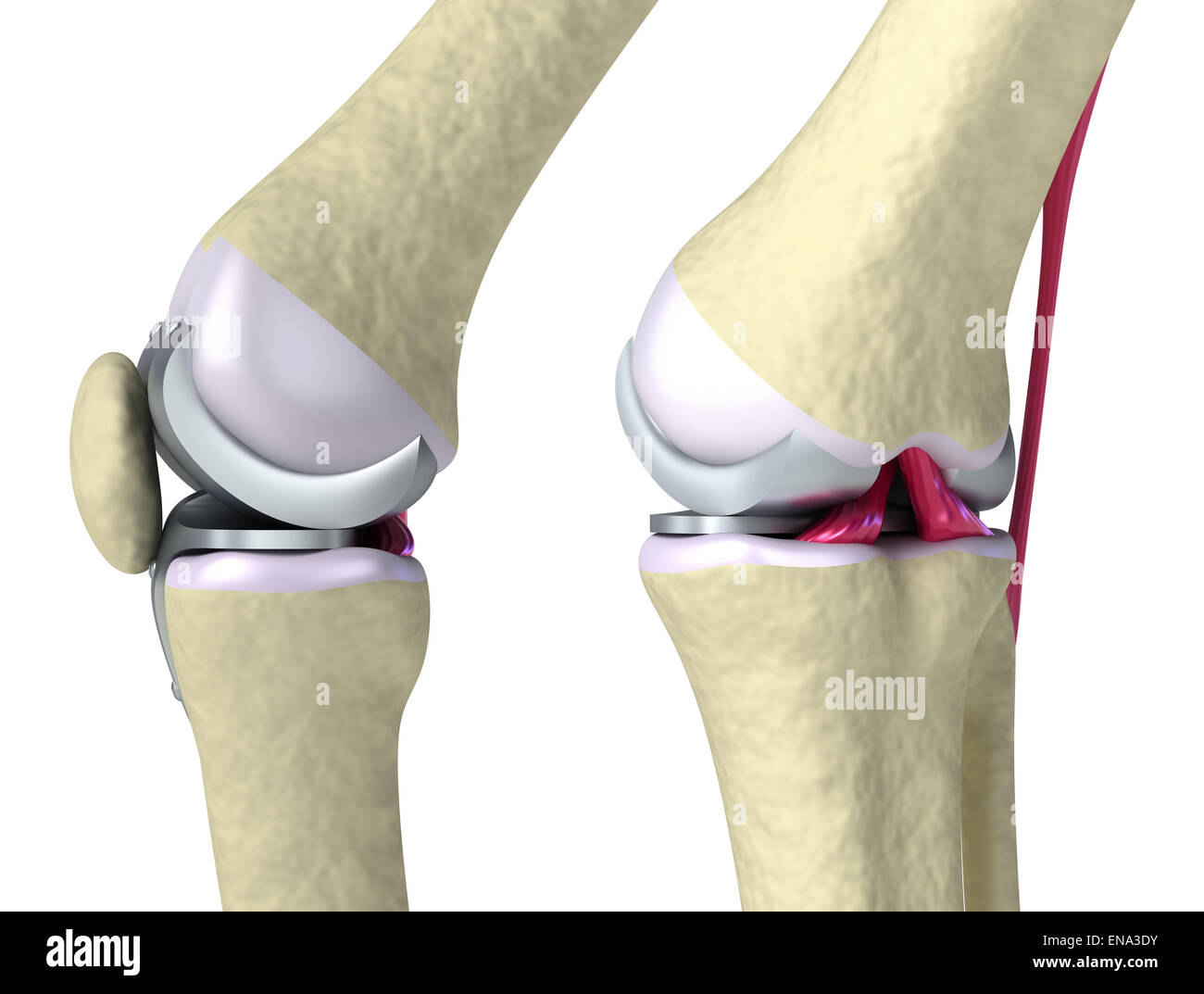Knee and titanium hinge joint. Isolated on white Stock Photo Alamy