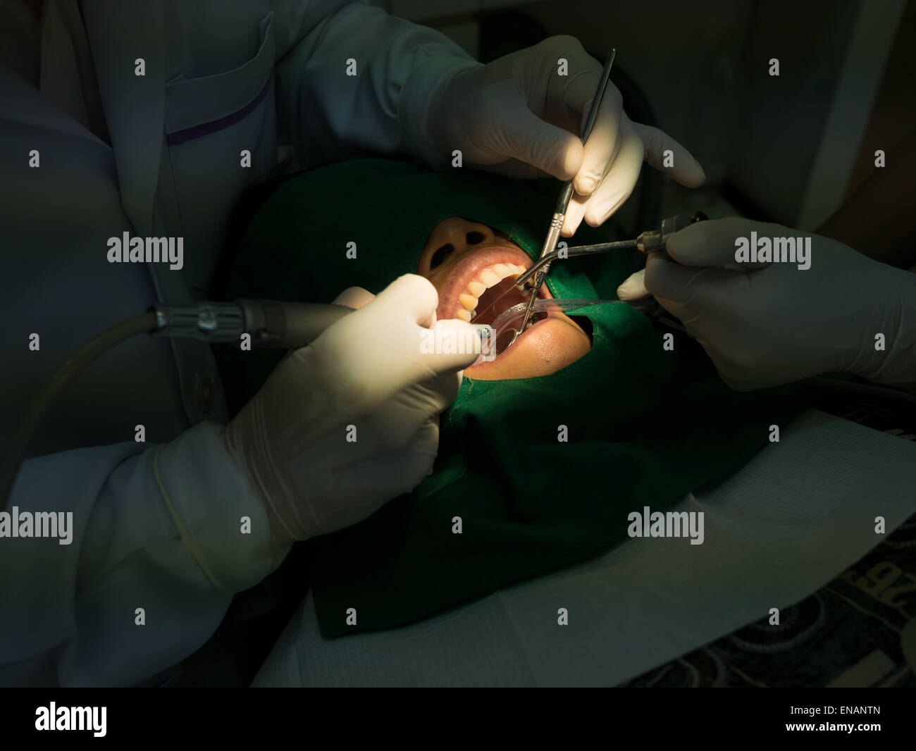 female patient having her teeth examined by specialist and dentist filling her teeth Stock Photo