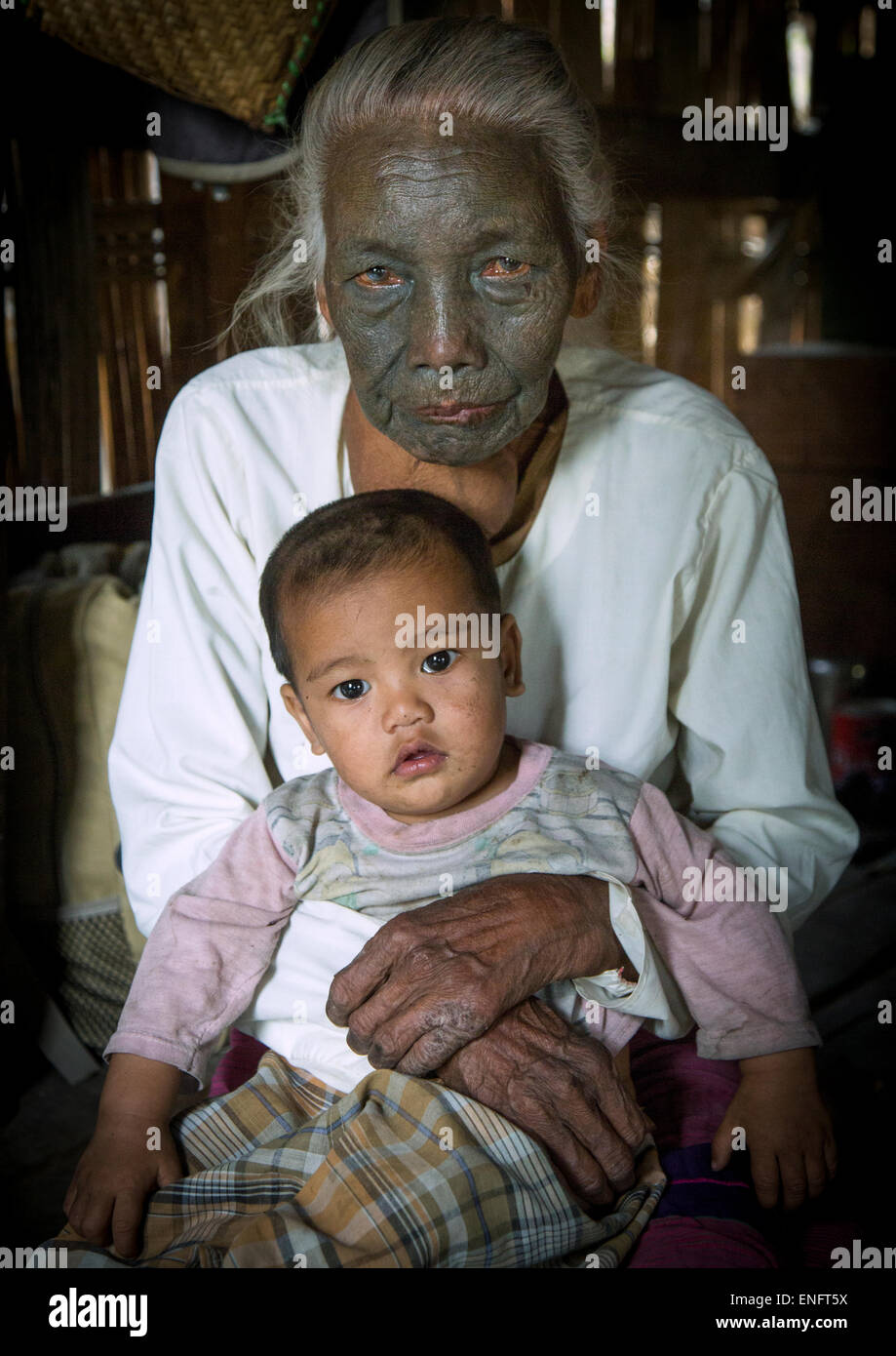 Tribal Chin Woman From U Pu Tribe With Tattoo On The Face Holding 