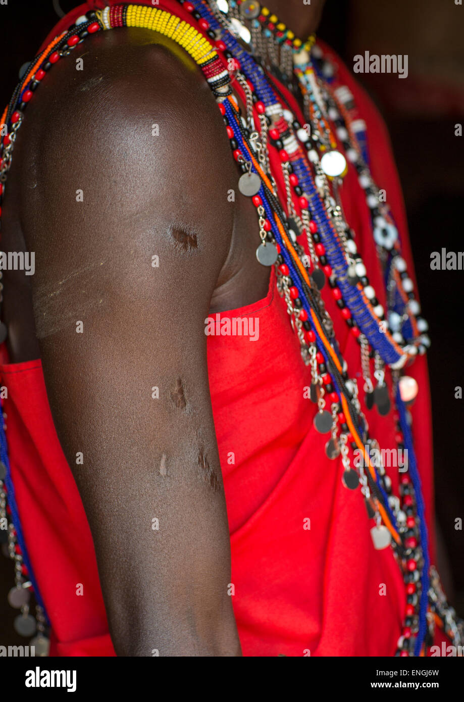Masai Warrior With Wounds On His Arm Made By A Lion, Nakuru County, Nakuru, Kenya Stock Photo