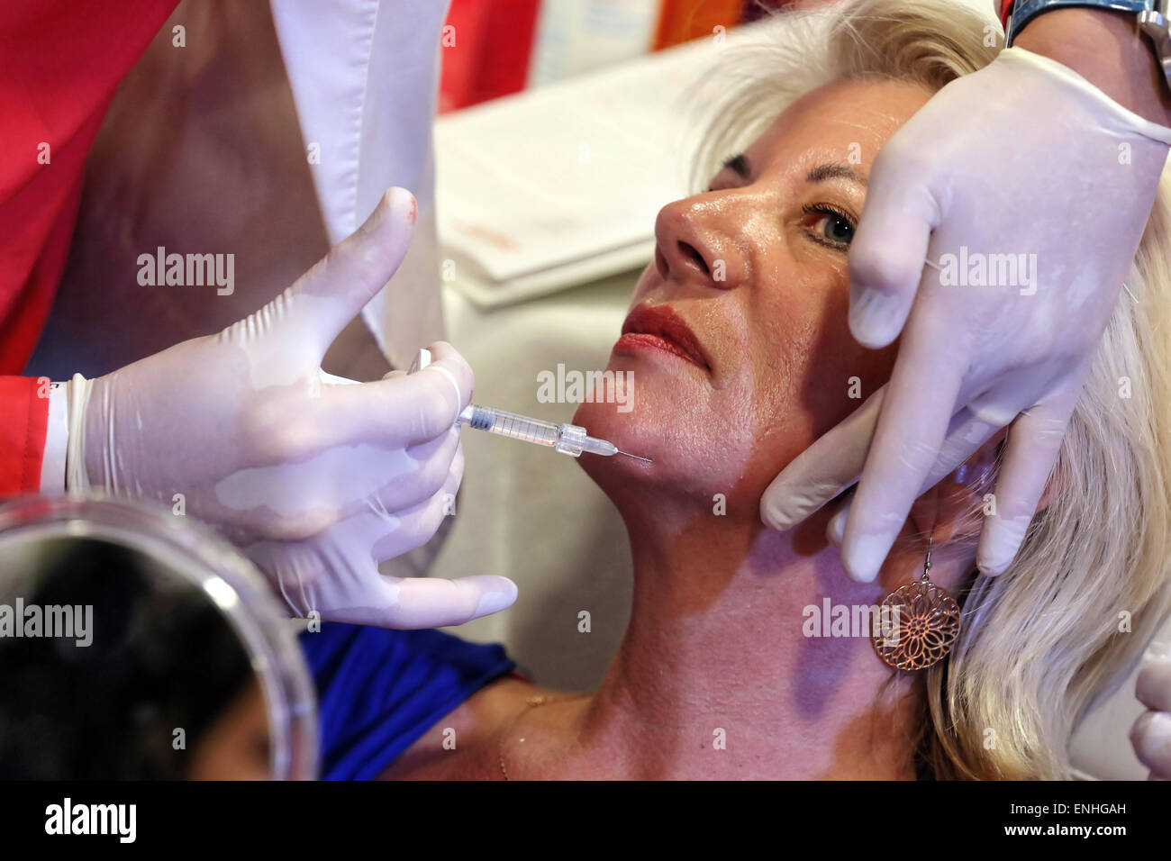 A facial plastic surgery specialist injected hyaluronic acid under the facial skin of a  client. Dortmund, Germany Stock Photo