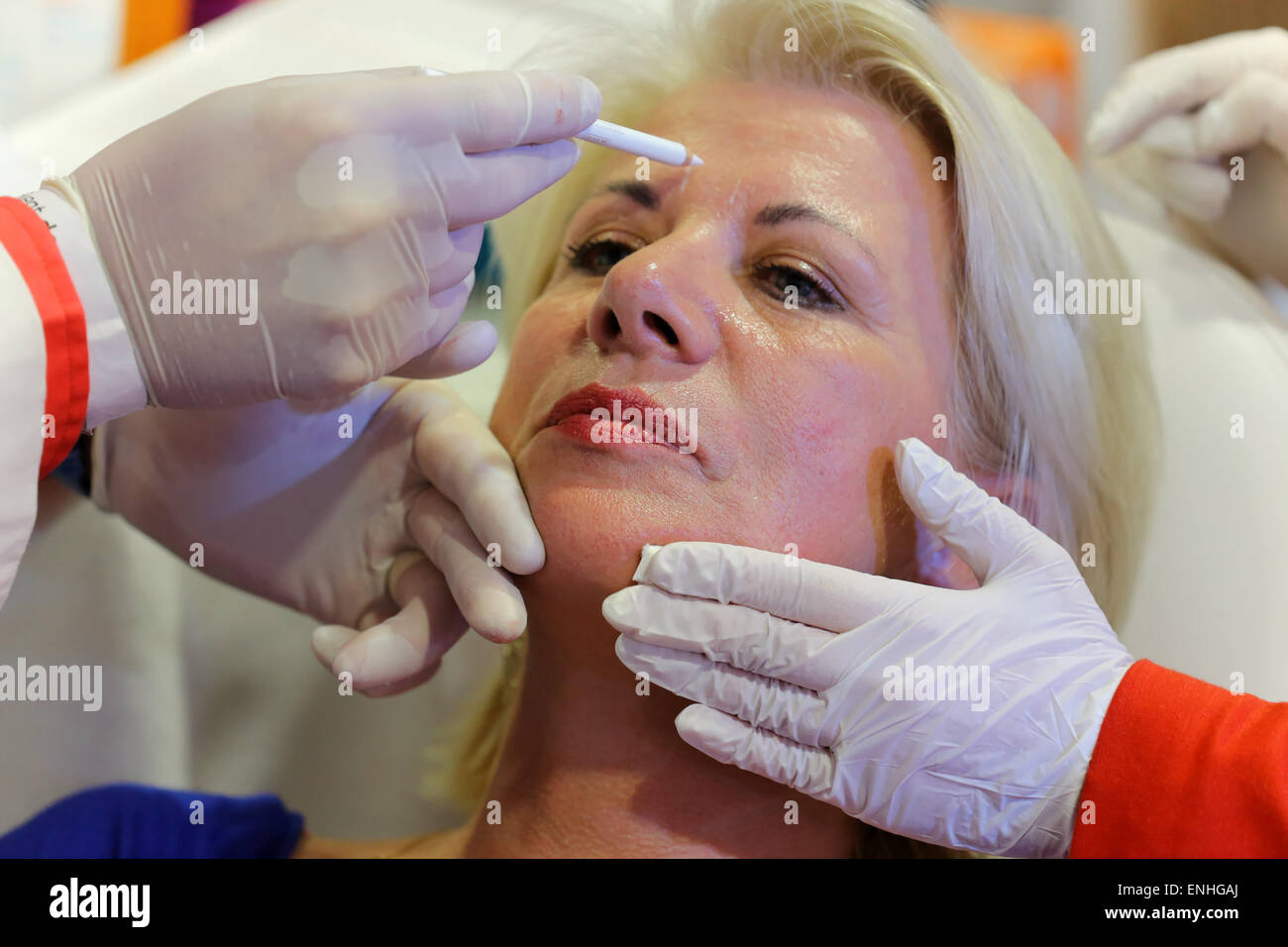 A facial plastic surgery specialist marks the facial skin of a client to inject hyaluronic acid. Dortmund, Germany Stock Photo