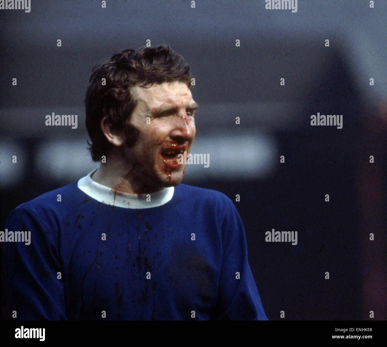 FA Cup Semi Final match at Old Trafford, Manchester. Liverpool 2 v Everton 1. John Morrisey with his face covered in blood after a goalmouth collision. 27th March 1971. Stock Photo