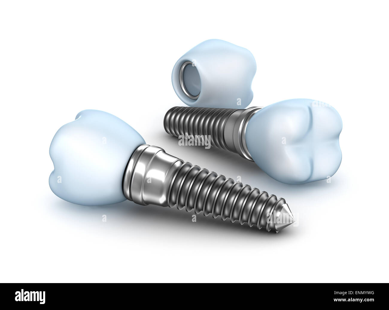 Dental implants, crown with pin isolated on white Stock Photo Alamy