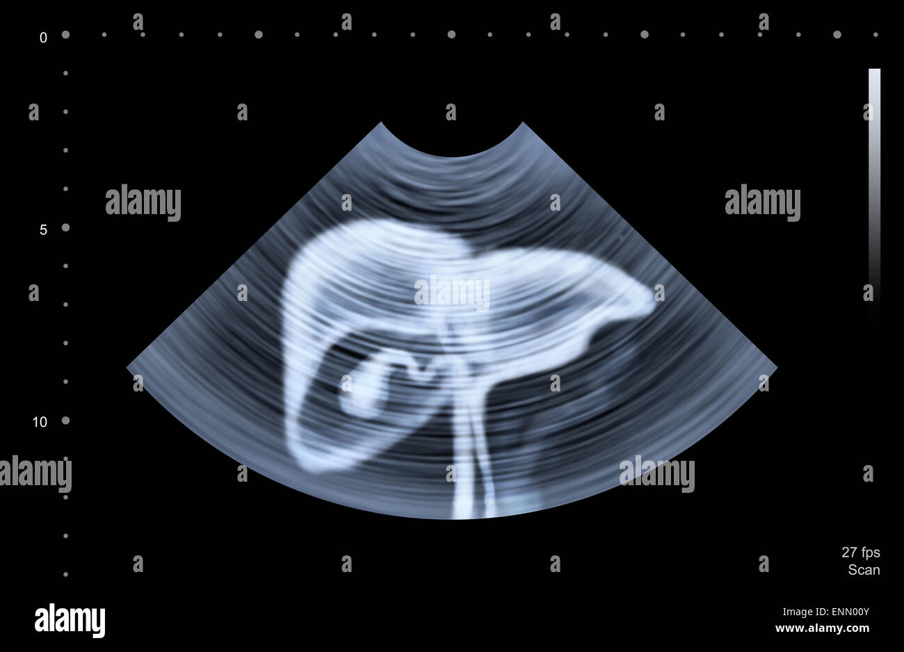 Ultrasound scan of human liver Stock Photo Alamy