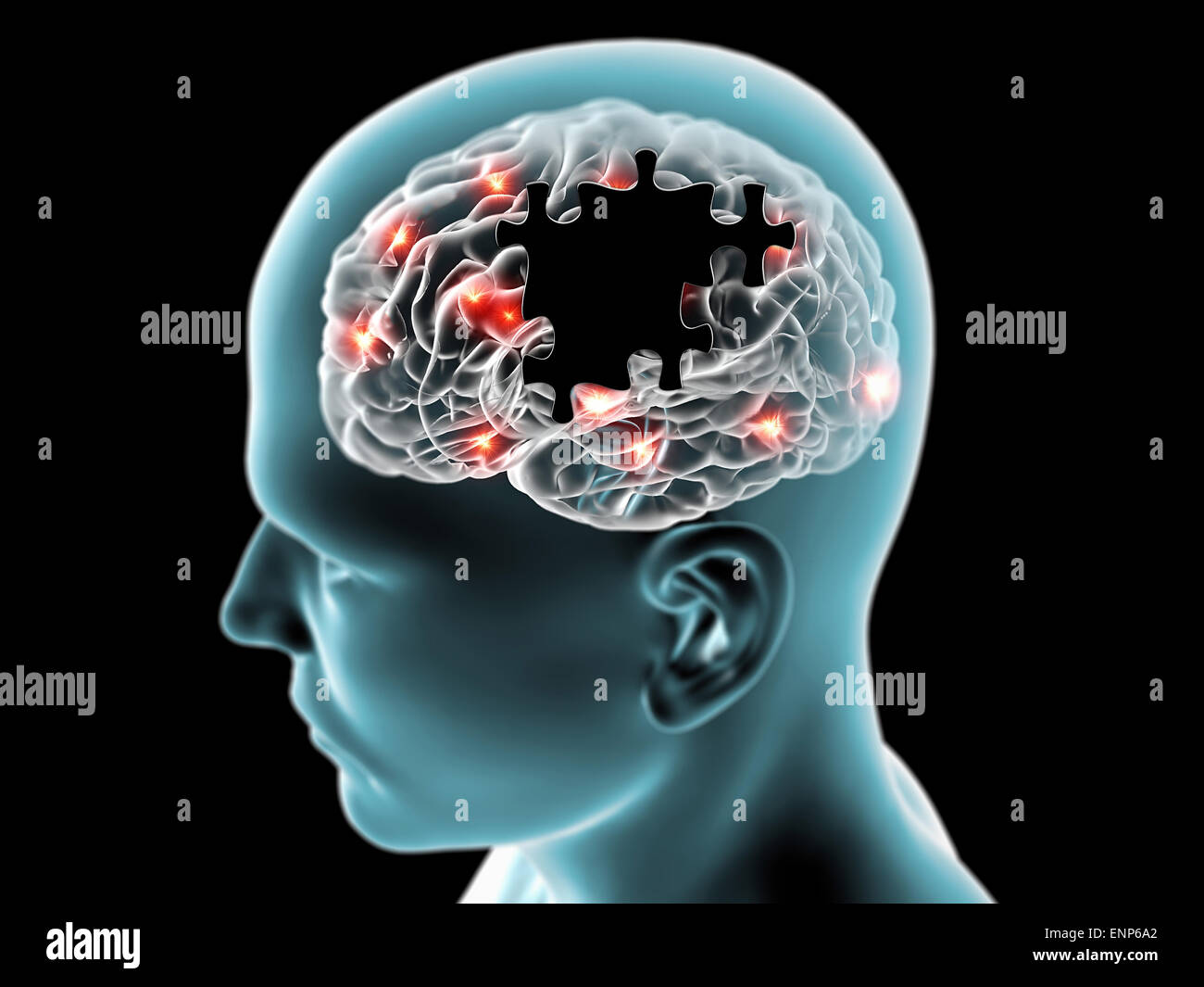 Brain degenerative diseases Parkinson, Alzheimer, Stock Photo