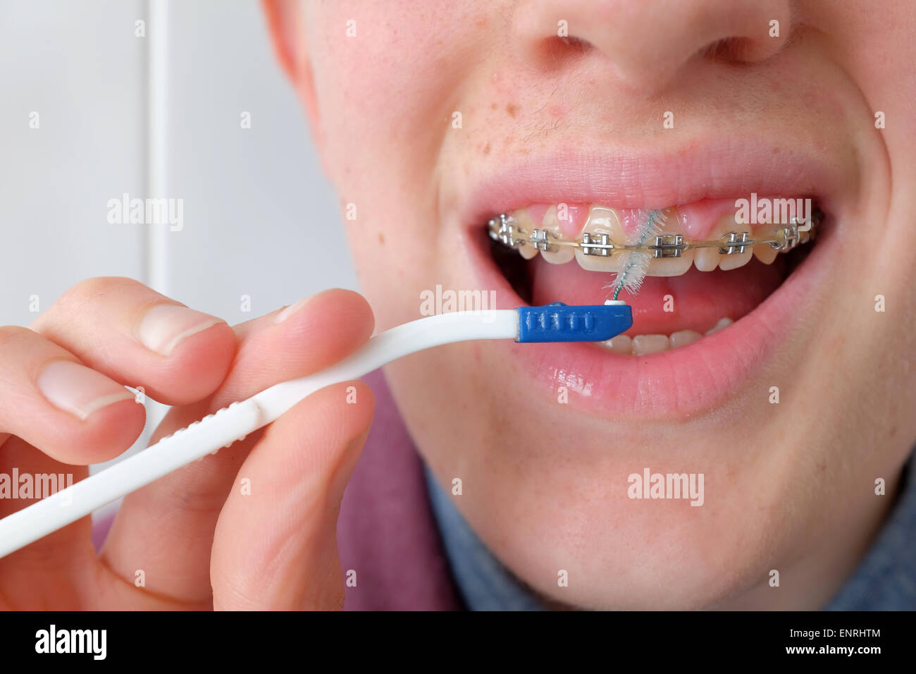 Teenage boy cleaning his teeth and braces with a brush close up Stock Photo