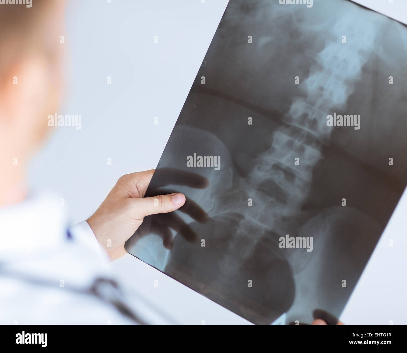 Doctor xray hi-res stock photography and images - Alamy