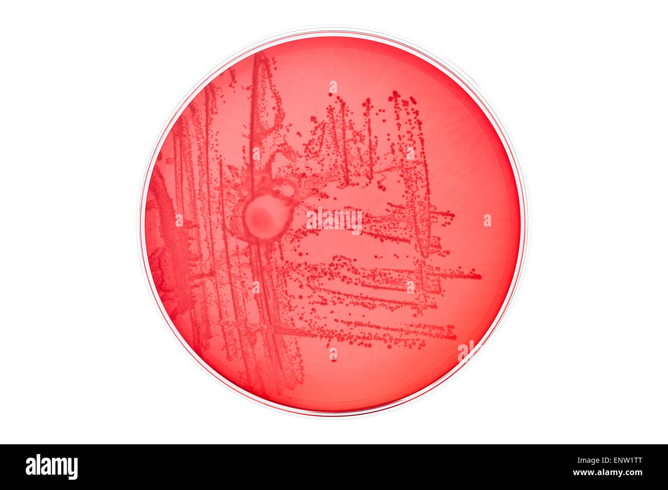 MacConkey agar a selective clinical microbiology lab culture medium to