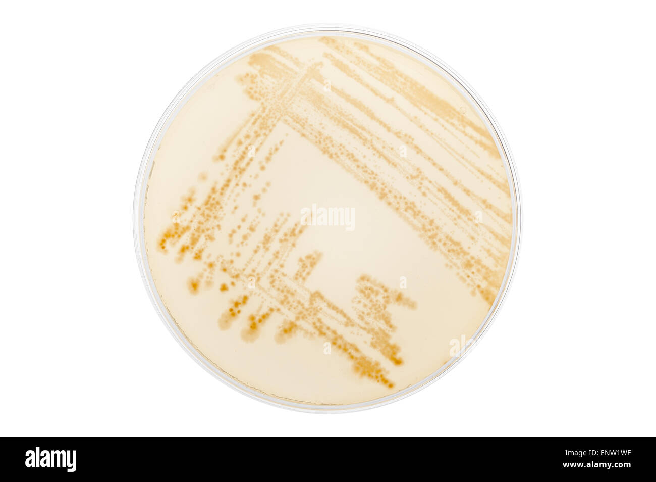 MacConkey agar a selective clinical microbiology lab culture medium to