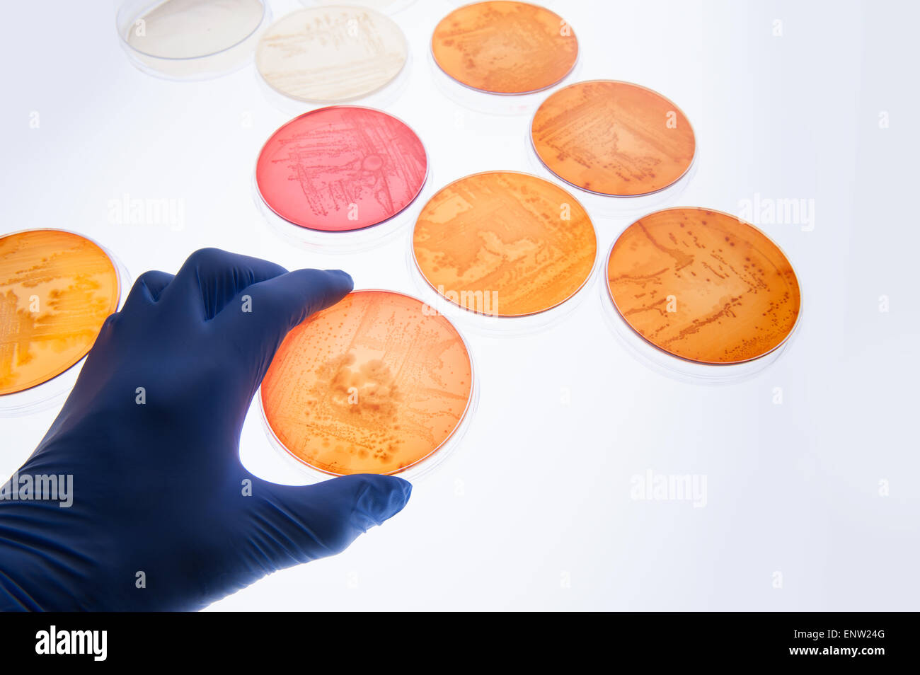 MacConkey agar a selective clinical microbiology lab culture medium to