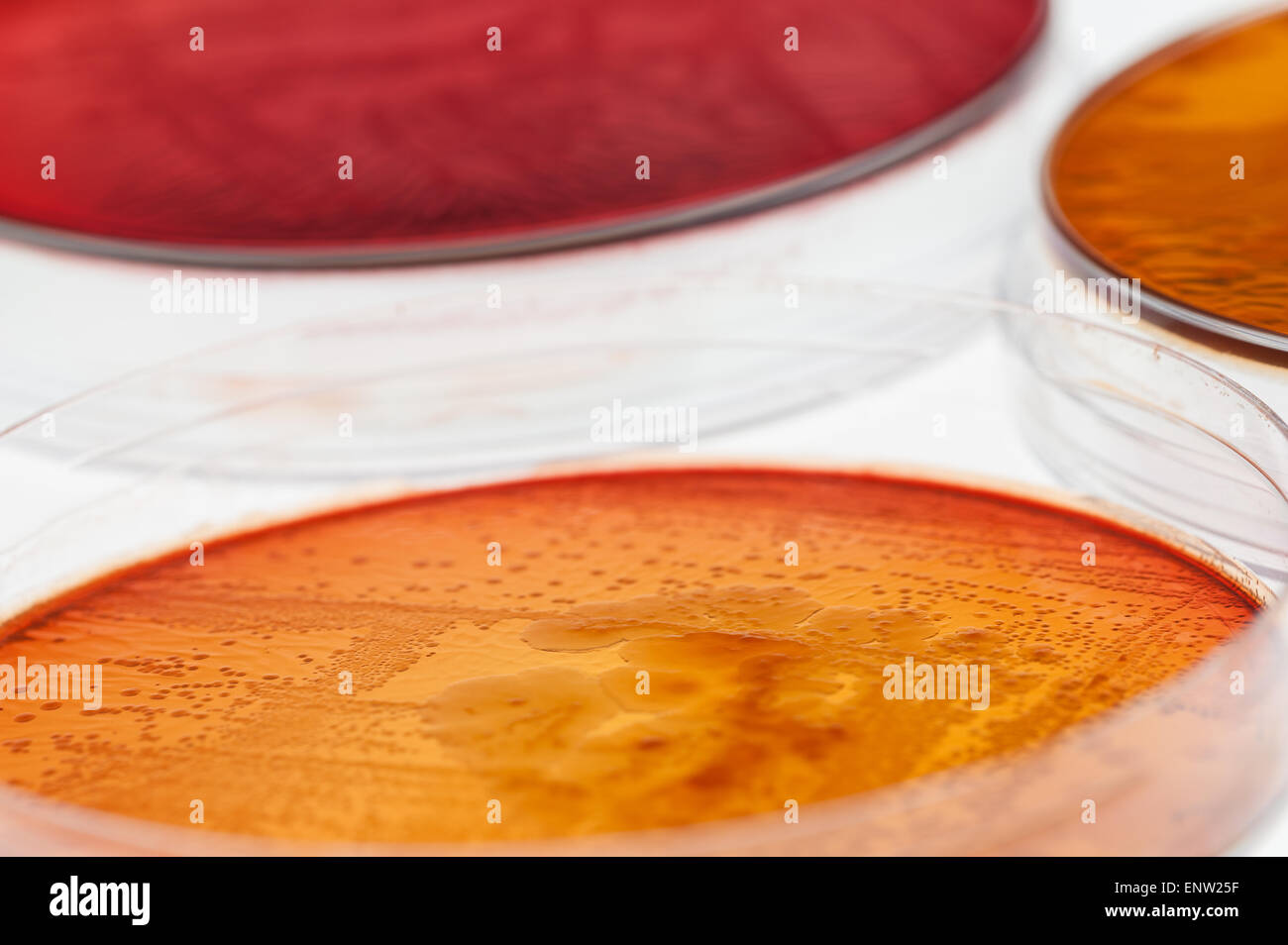 MacConkey agar a selective clinical microbiology lab culture medium to