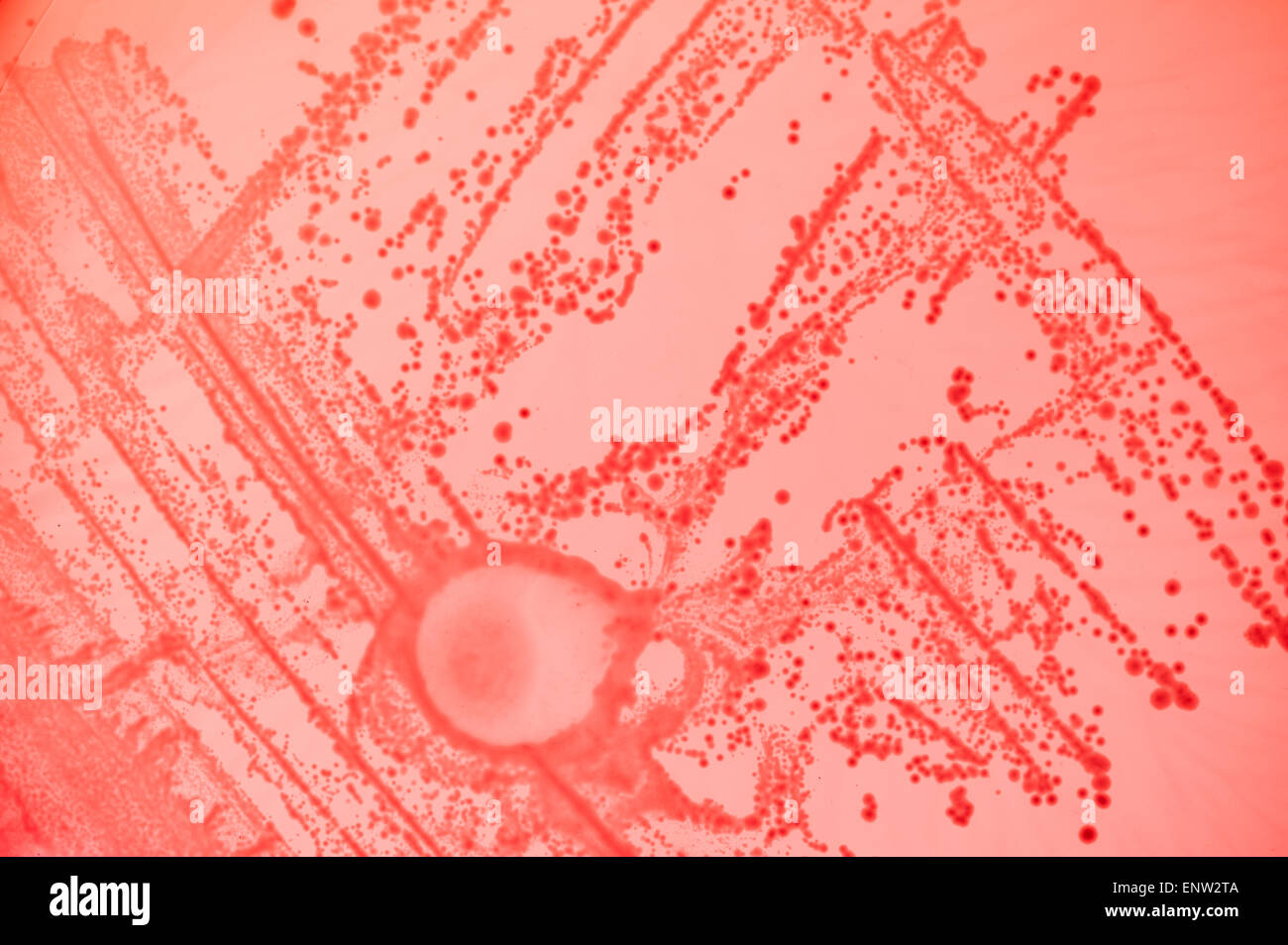 MacConkey agar a selective clinical microbiology lab culture medium to