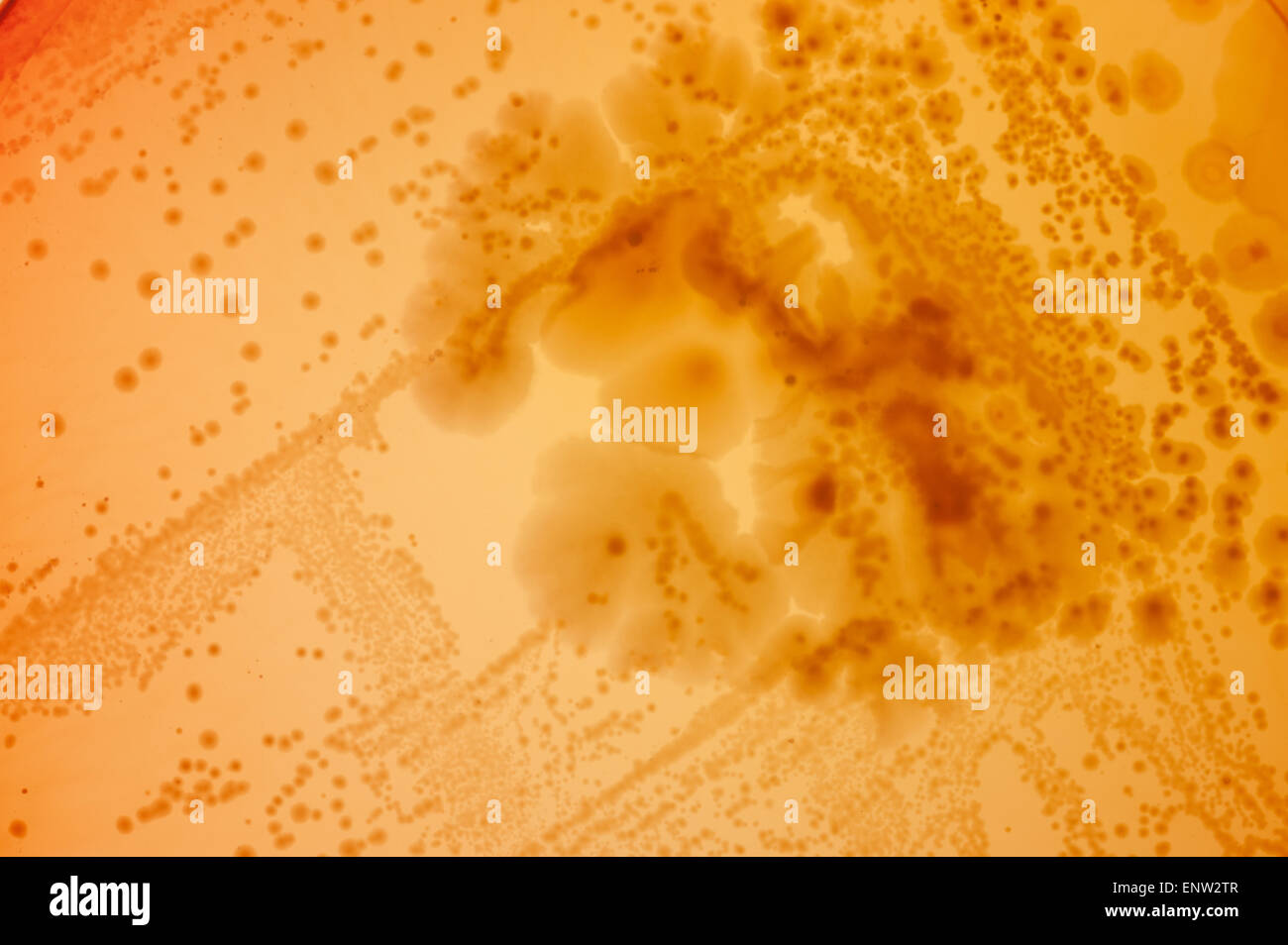 MacConkey agar a selective clinical microbiology lab culture medium to