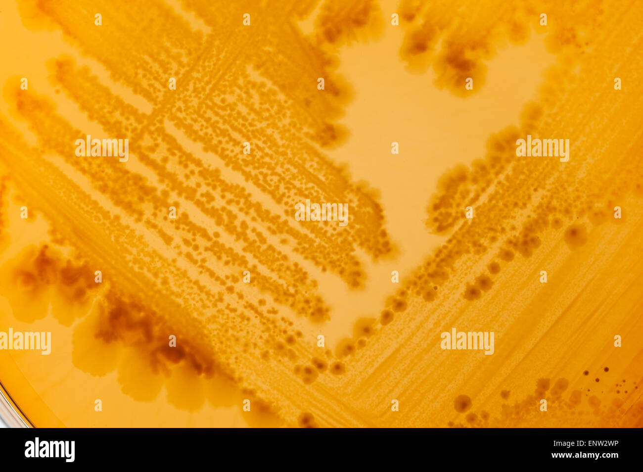 MacConkey agar a selective clinical microbiology lab culture medium to