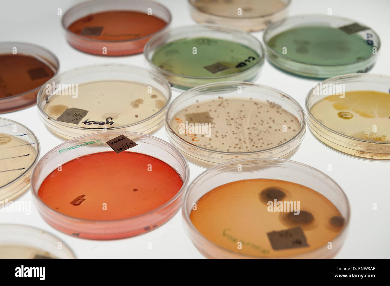 Selective Clinical Microbiology Lab Culture Medium To Isolate Gram explain-the-different-types-of-culture-media-amya-has-stewart