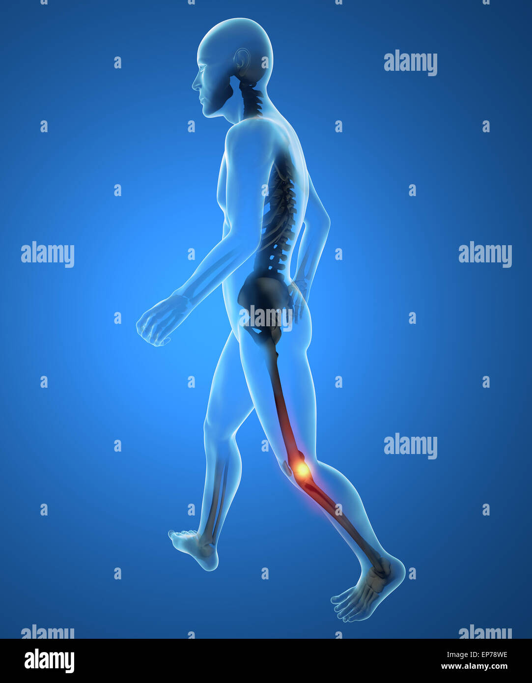 Men's skeleton, race knee inflammation pain Stock Photo