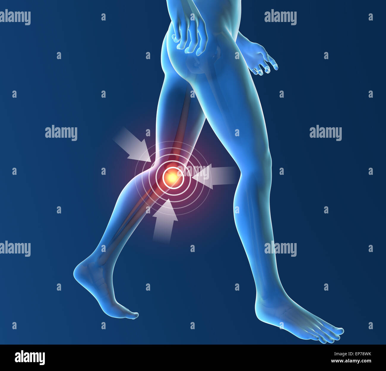 Men's skeleton, race knee inflammation pain Stock Photo