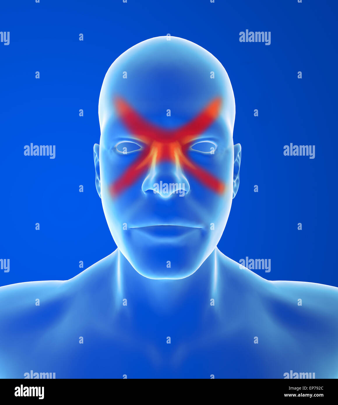 Type headache: Sinus pain is usually behind the forehead and cheekbones on blue background Stock Photo