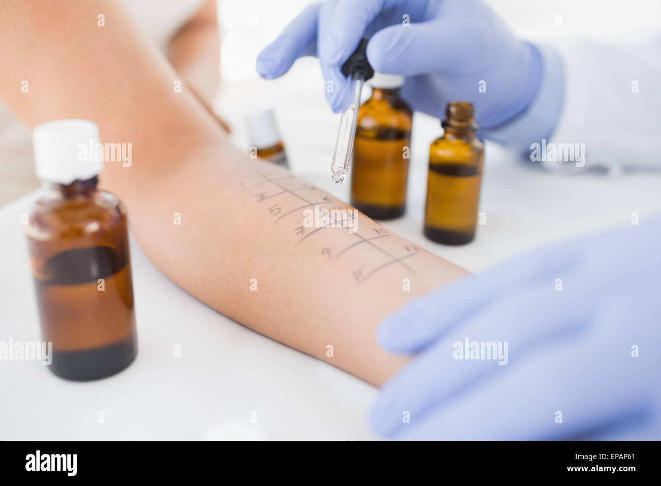 Physiotherapist dropping medicine on hand of patient Stock Photo
