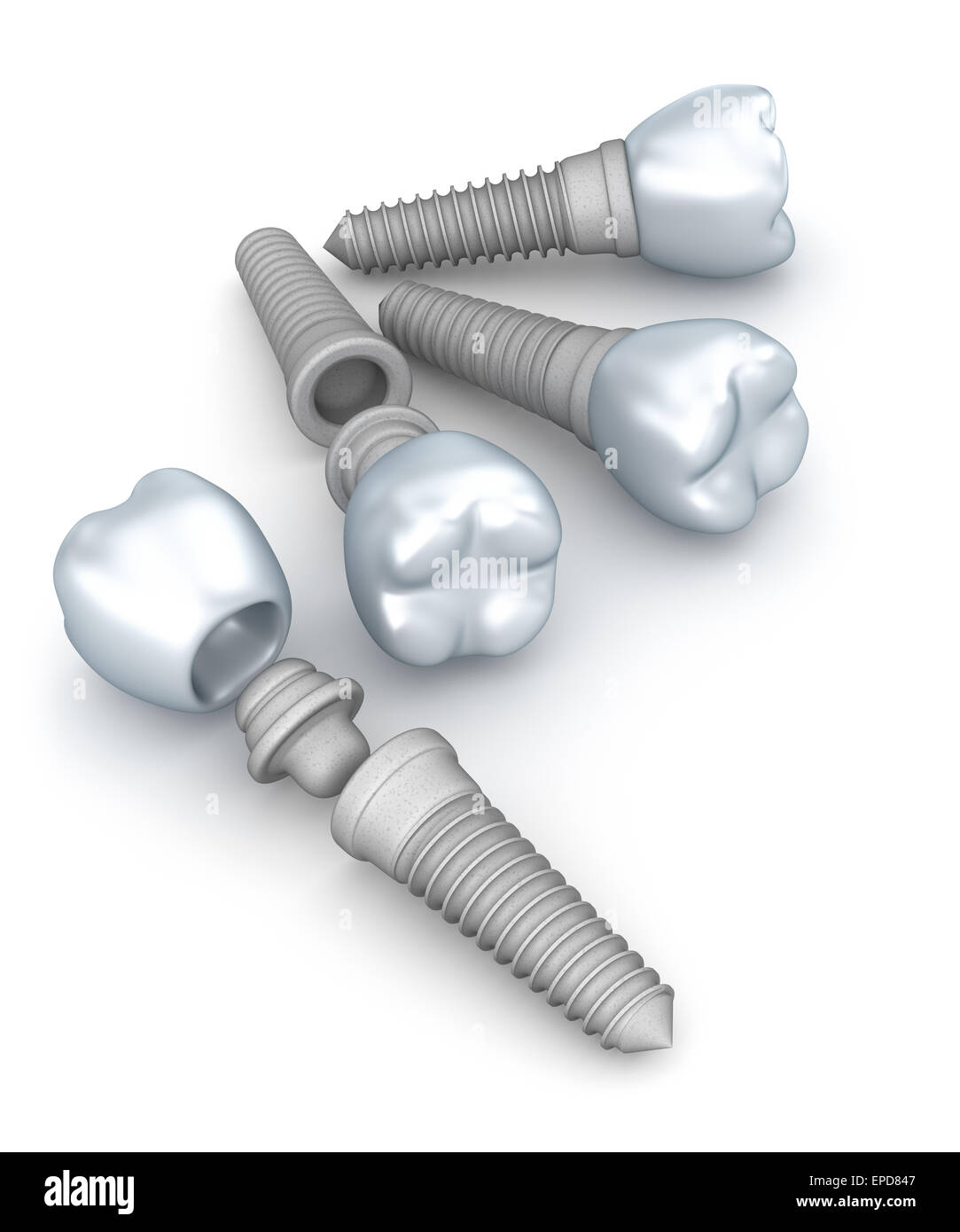 Dental implants, crowns and pins isolated on white Stock Photo