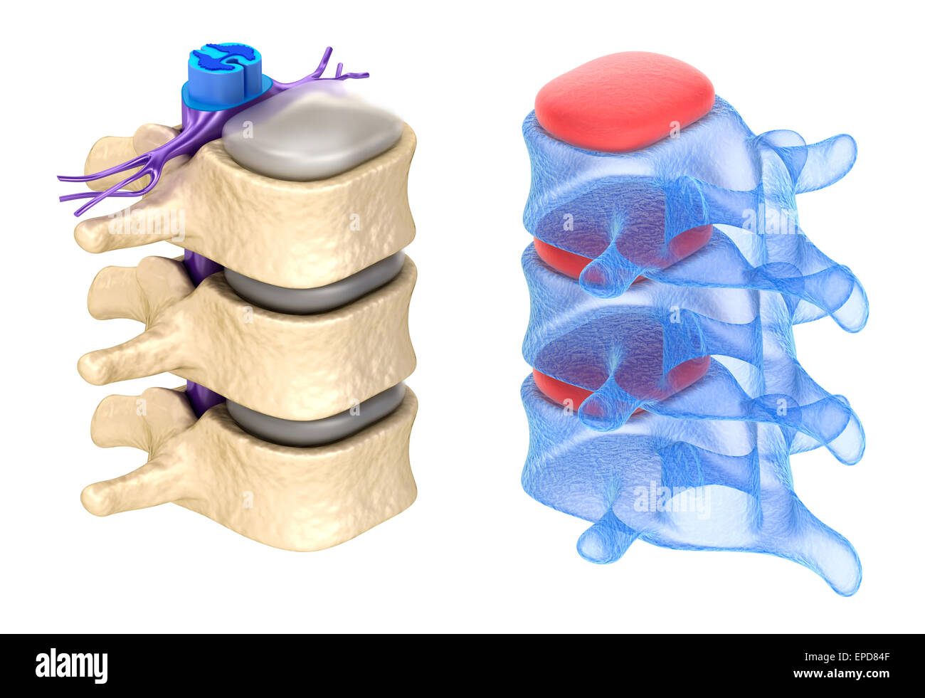 Disc extrusion hi-res stock photography and images - Alamy