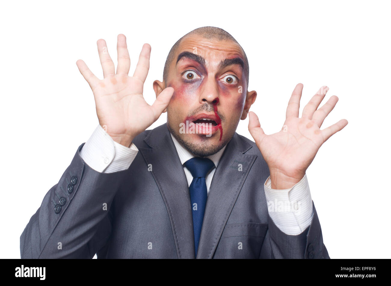 Badly beaten businessman isolated on white Stock Photo - Alamy