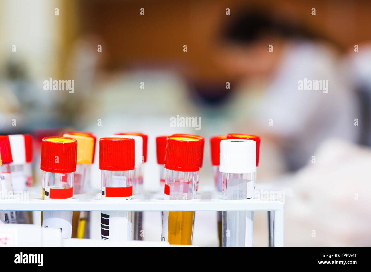 Blood samples in test tube rack Stock Photo