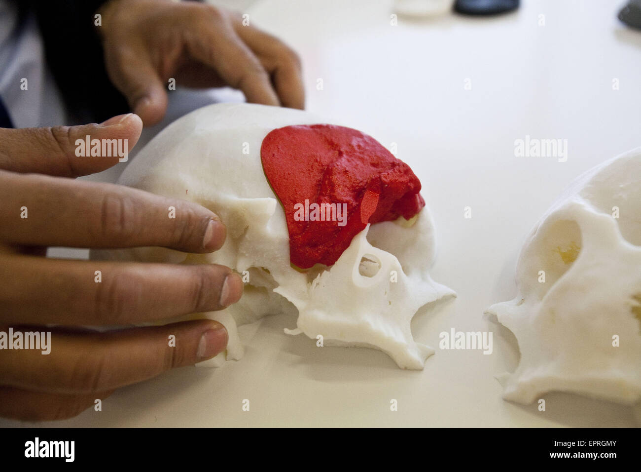London, UK. 21st May, 2015. Pioneering cranio-maxillofacial reconstruction using 3D printing.Reflecting the incredible impact of 3D printing within the medical sector, the pioneering work undertaken by the UKâ€™s largest Cranio-Maxillofacial Prosthetics Unit, based at King's College Hospital is being shown at the 3D Print Show London. Credit:  ZUMA Press, Inc./Alamy Live News Stock Photo
