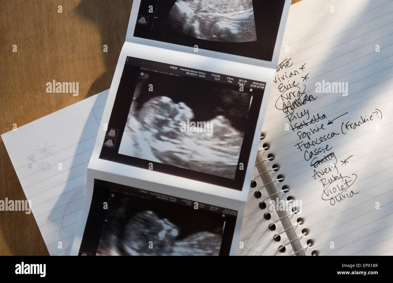 Ultrasound picture of baby with list of names Stock Photo