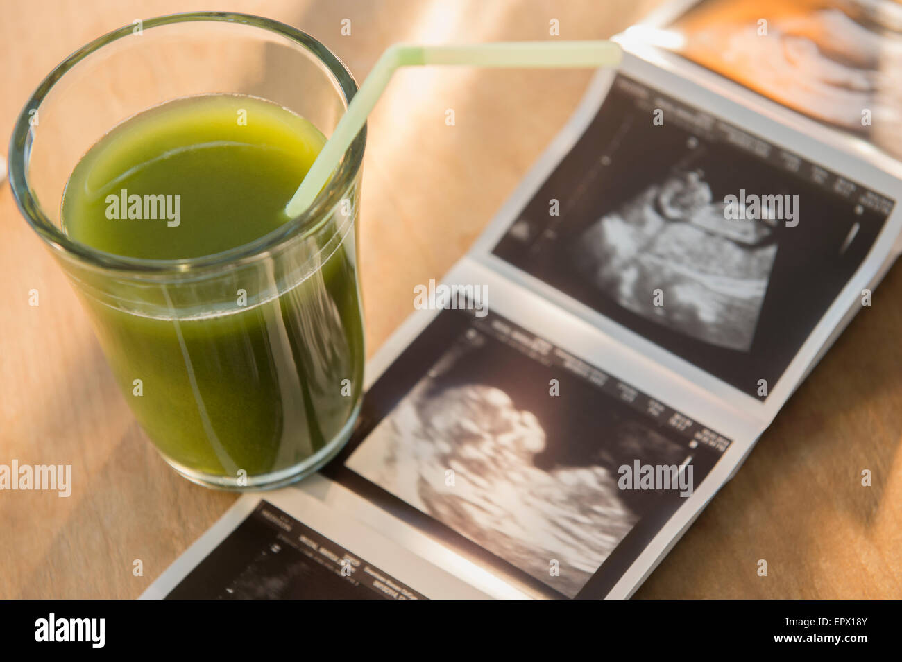 Ultrasound picture and vegetable juice Stock Photo Alamy