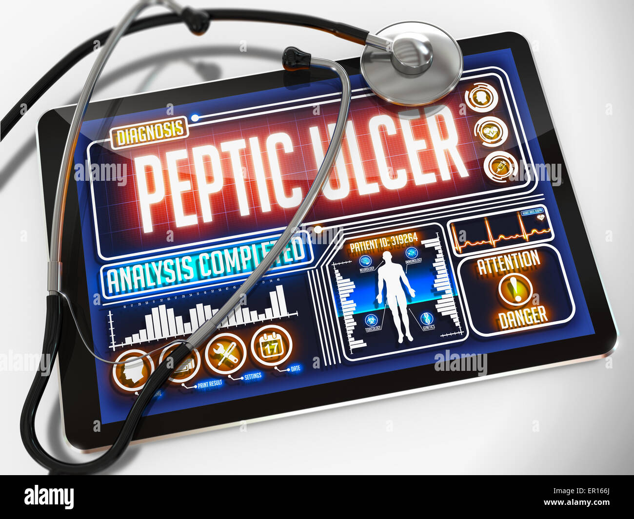 Peptic Ulcer on the Display of Medical Tablet. Stock Photo