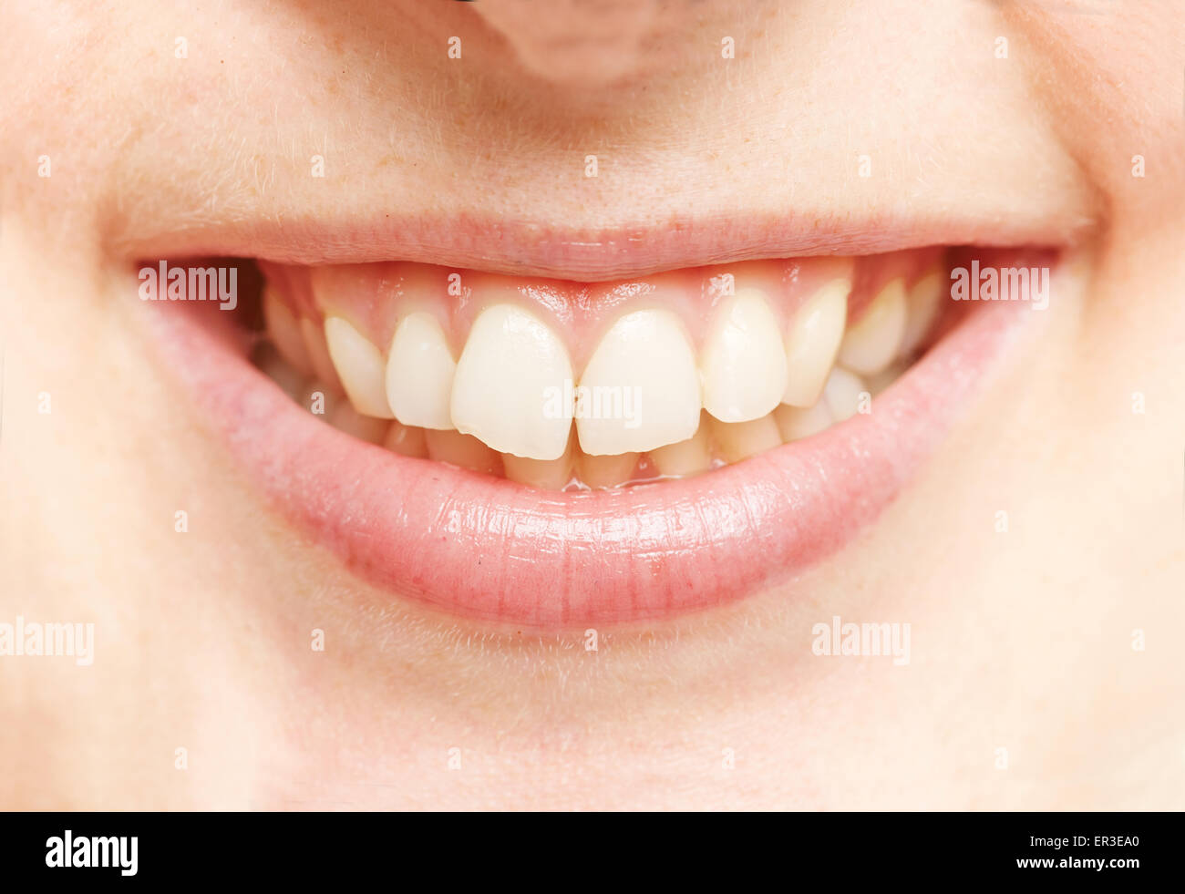 Woman healthy gums teeth hi-res stock photography and images - Alamy