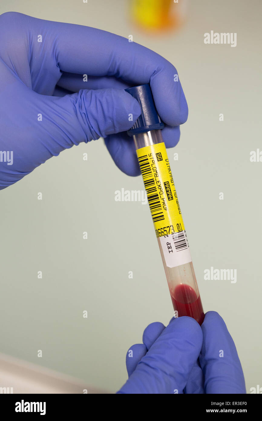 Analysis of lead in the blood (lead poisoning). Laboratory of Environmental Analytical Toxicology and Occupational Health. Biology and Research Center. Stock Photo