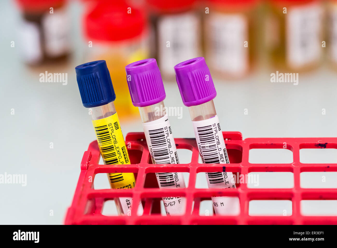 Analysis of lead in the blood (lead poisoning). Laboratory of Environmental Analytical Toxicology and Occupational Health. Biology and Research Center. Stock Photo