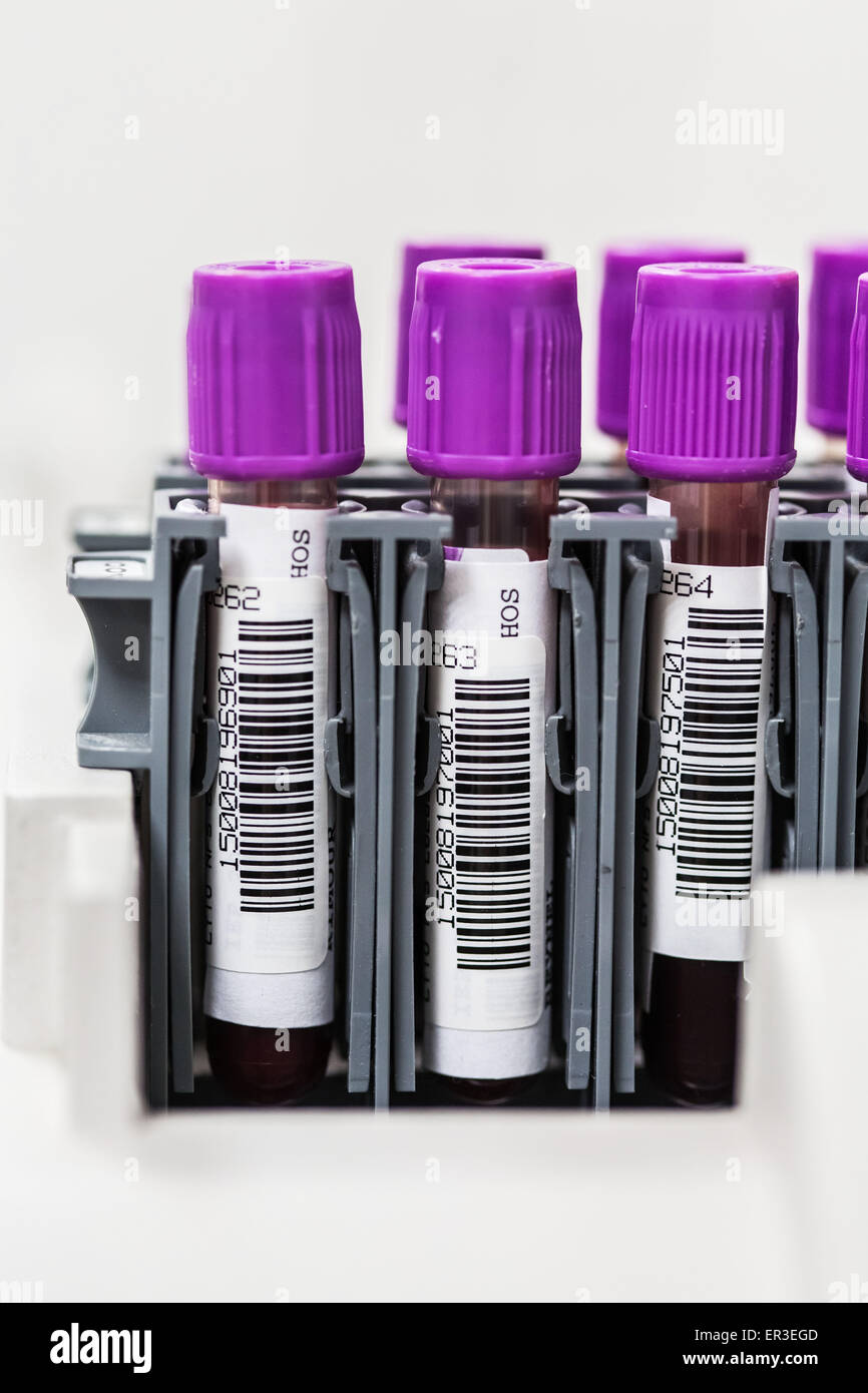 Blood analysis in laboratory. Stock Photo